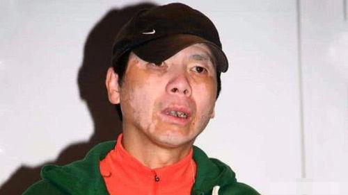 白癜风明星,揭秘白癜风明星的勇敢生活